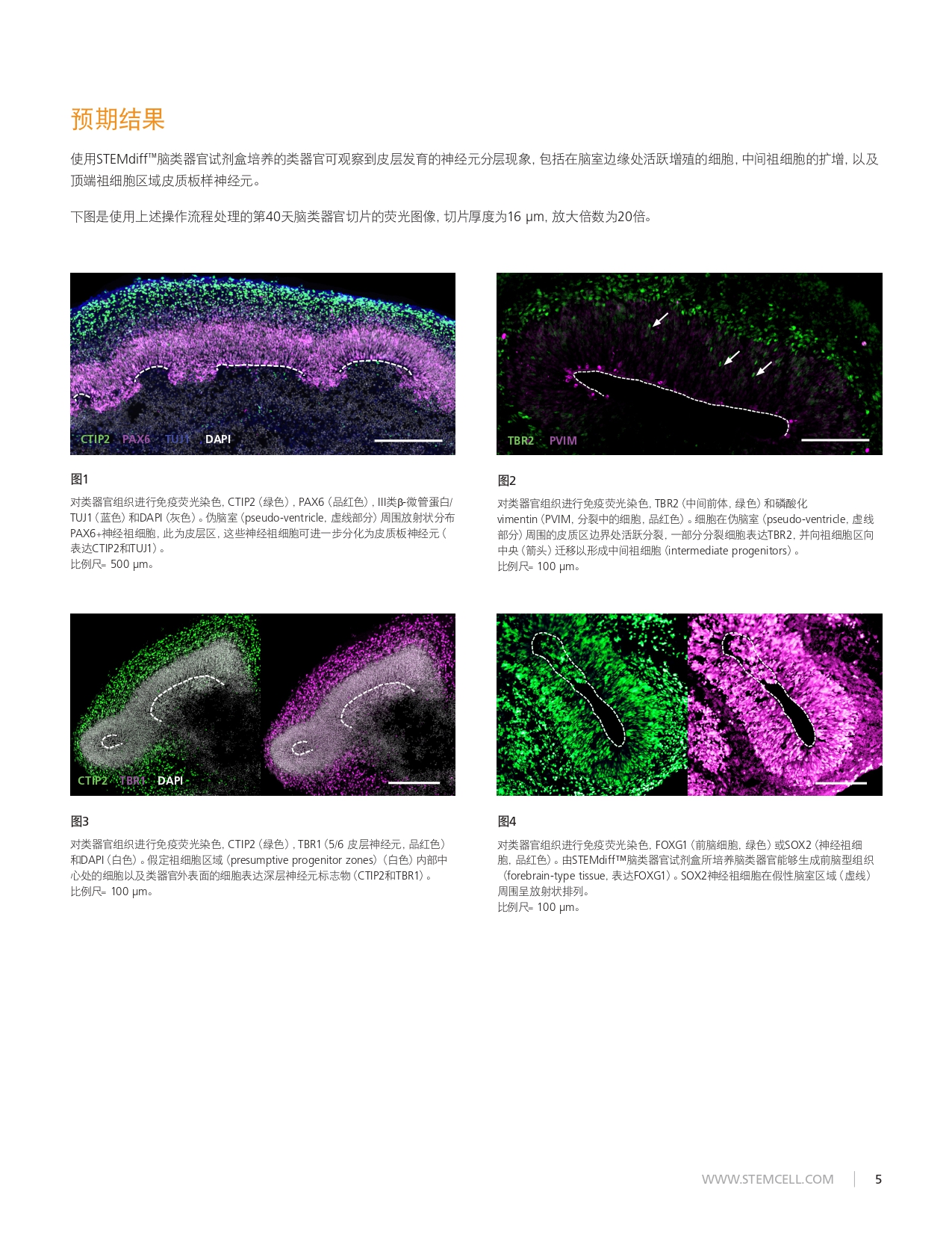 脑类器官的冷冻切片和荧光染色TB27171CN-Cryogenic_Tissue_Processing_and_Section_Immunofluorescence_of_Cerebral_O.jpg